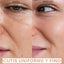 Skin Exfoliating Peeling | Limpieza profunda de poros